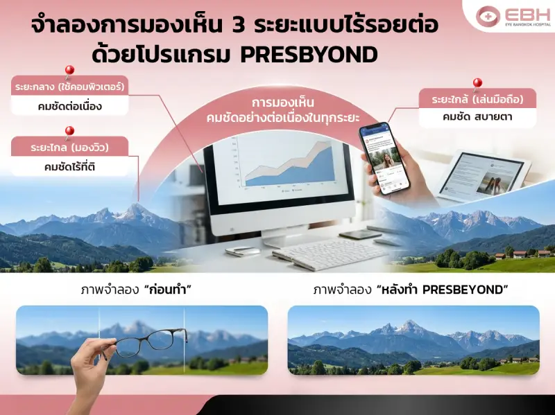 *ผลการรักษาขึ้นอยู่กับแต่ละบุคคล